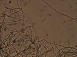 fungal hyphae with yeast